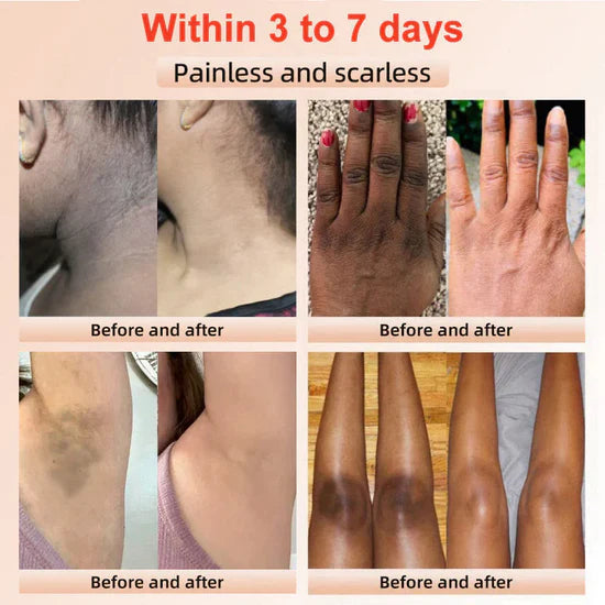 Orange Enzymes Exfoliating Brightening Gel