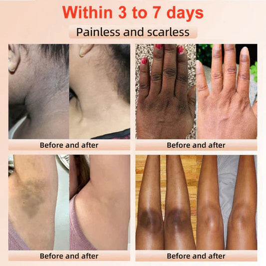 Orange Enzymes Exfoliating Brightening Gel